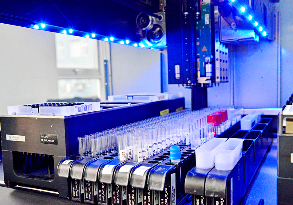 全自动酶免加样系统